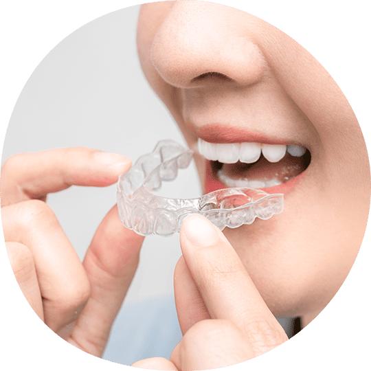 Mouthpiece Orthodontics（マウスピース矯正）