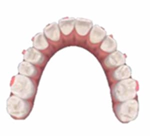 治療後の歯並び