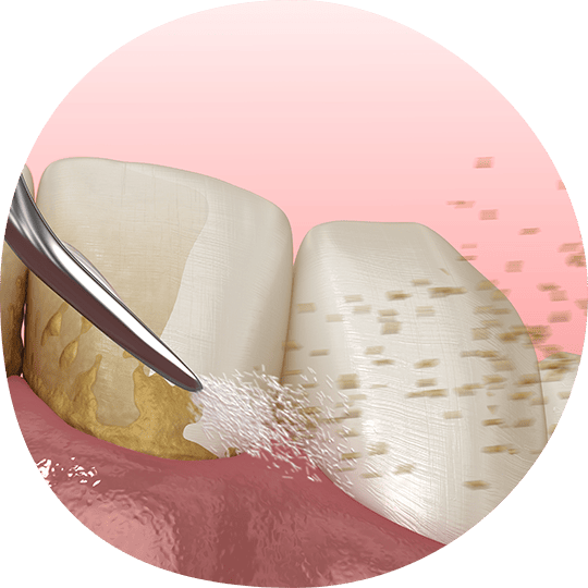 OCクリーニング