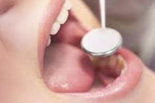 準備・口腔内チェック